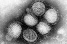 virus